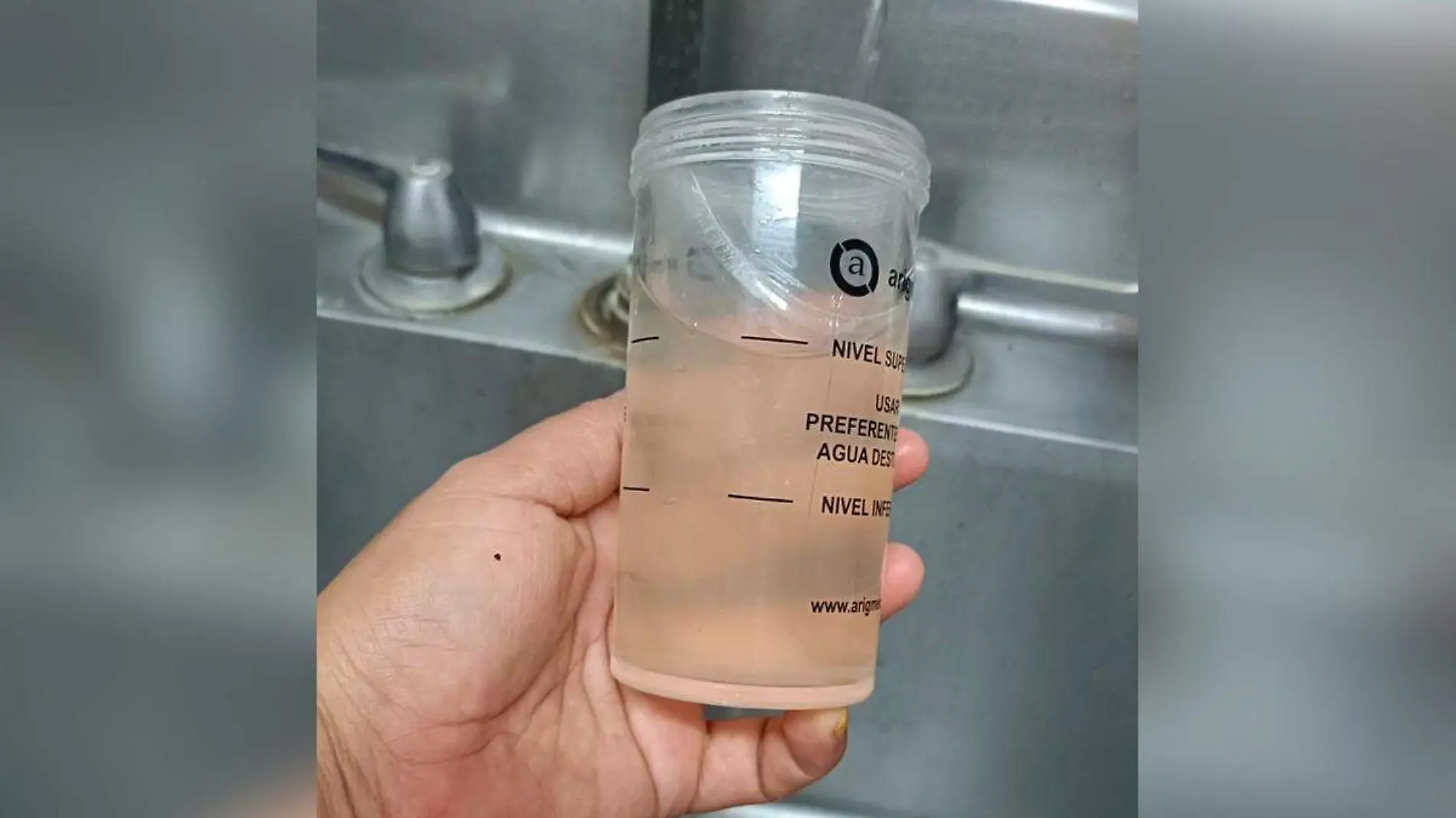 agua contaminada en hospital